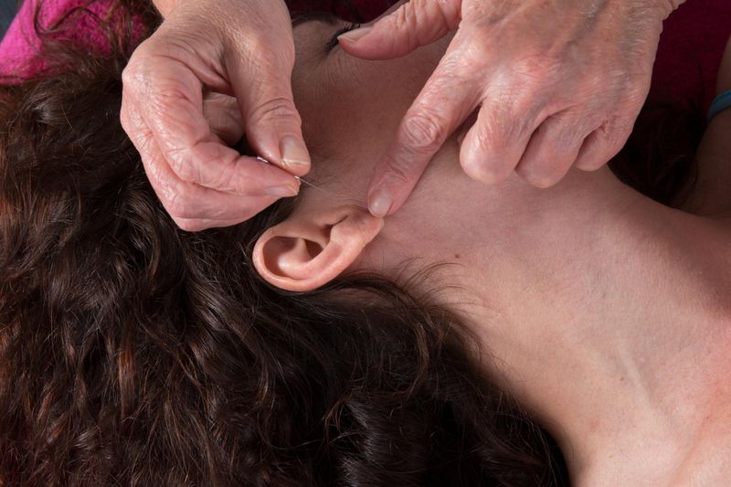 Kulak akupunkturu yaptıran kadın